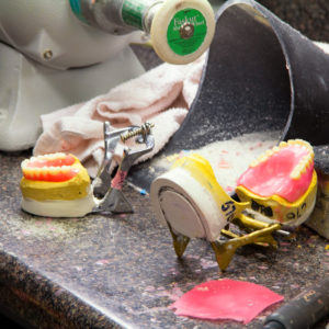 dentures in process of being fabricated | Reliable Dental Lab | Dallas, TX