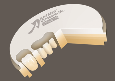 Katana Zirconia Multi Layerd | Reliable Dental Lab | Dallas, TX